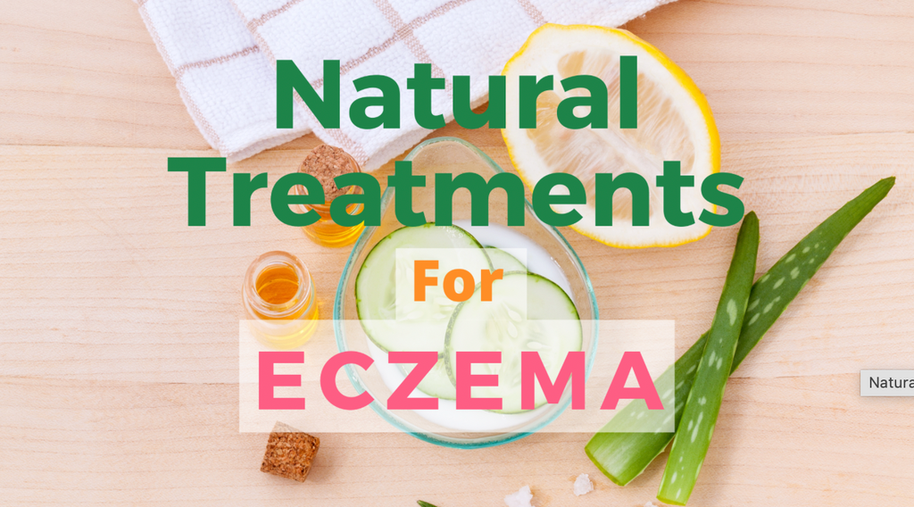 Why You Need to Moisturize for Eczema Prevention – Tres Keikis